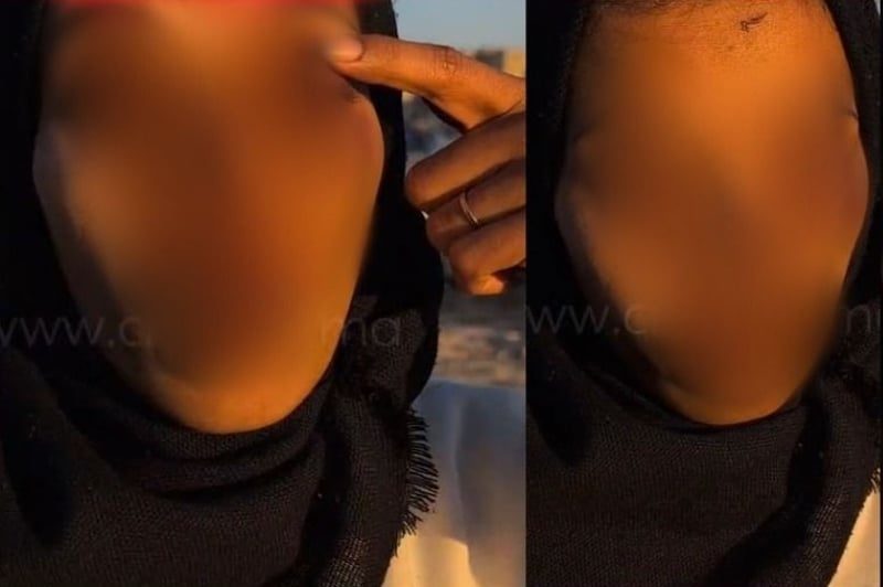 الدار البيضاء: توقيف مشتبه فيه في قضية ضرب وجرح بفضل تسجيل فيديو